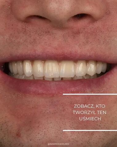 Leczenie zębów pod narkozą w Gdańsku - zobacz kto tworzył ten uśmiech